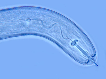 Sugarbeet cyst nematode juvenile