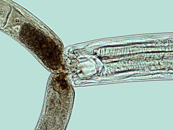 Mononchoid nematode feeding on another nematode. 